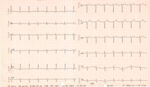 Miniatura obrazu 2 przedstawiająca badanie EKG 