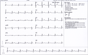Miniatura obrazu 5 przedstawiająca badanie EKG 