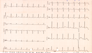 Miniatura obrazu 24 przedstawiająca badanie EKG 
