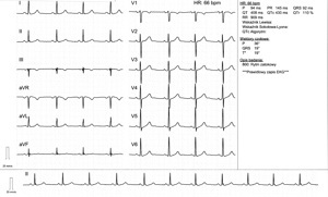 Miniatura obrazu 11 przedstawiająca badanie EKG 