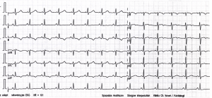 Miniatura obrazu 28 przedstawiająca badanie EKG 