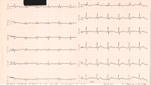 Miniatura obrazu 3 przedstawiająca badanie EKG 